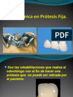 Biomecanica en PPF