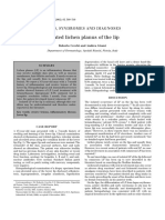 Isolated Lichen Planus of The Lip: S Ign S, Syn Drom Es and Diagnos Es