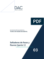 Tema 3 - Selladores de Fosa y Fisura