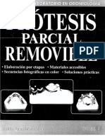 Protesis Parcial Removible