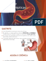 Gastrite e Úlceras Pépticas - AULA 1