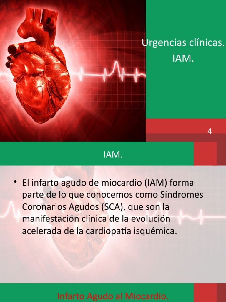 Infarto Agudo de Miocardio: Diagnóstico y Tratamiento | PDF | Infarto ...