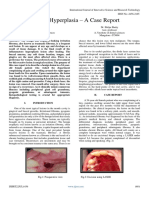 Fibrous Hyperplasia - A Case Report