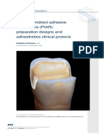 Posterior Indirect Adhesive Restorations (PIAR) : Preparation Designs and Adhesthetics Clinical Protocol