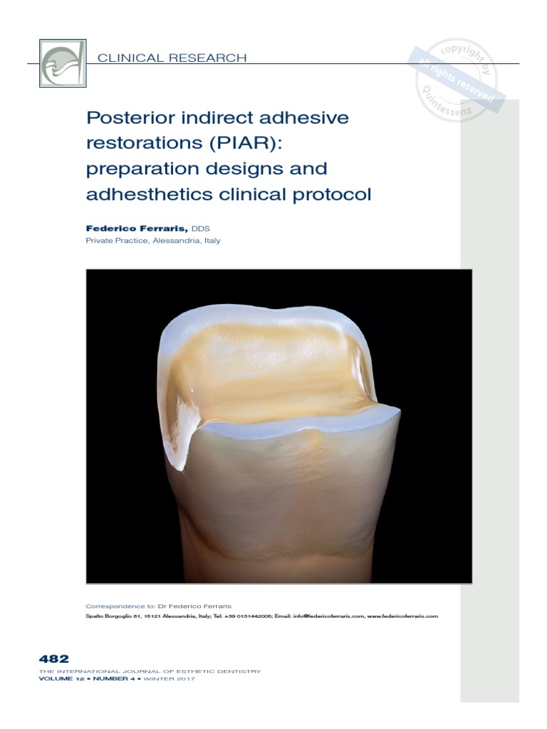 Posterior Indirect Adhesive Restorations (PIAR) Preparation Designs
