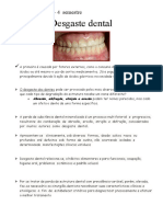 Desgaste dental: causas, tipos e tratamento