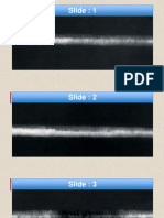 2. RTFI Weld Defect Interpretation 1