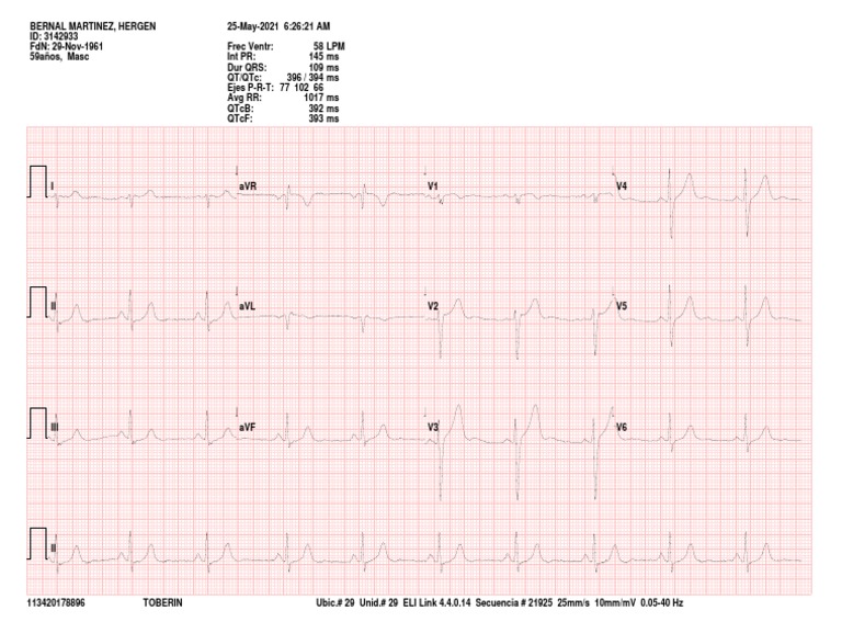 Bogtoberin E156 242110 Electrocardiograma Anexo 1 | PDF