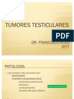 Tumores de testiculo