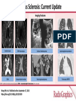 Imaging Features: Cardiac Rhabdomyomas Cortical Tubers WM Heterotopia Lymphangioleiomyomatosis