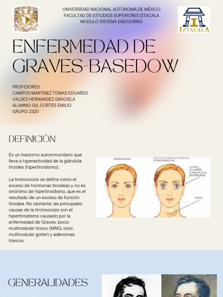 Enfermedad de GravesBasedow PDF Hipertiroidismo Epidemiología