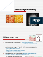 Hydatid Disease (Hydatidosis)