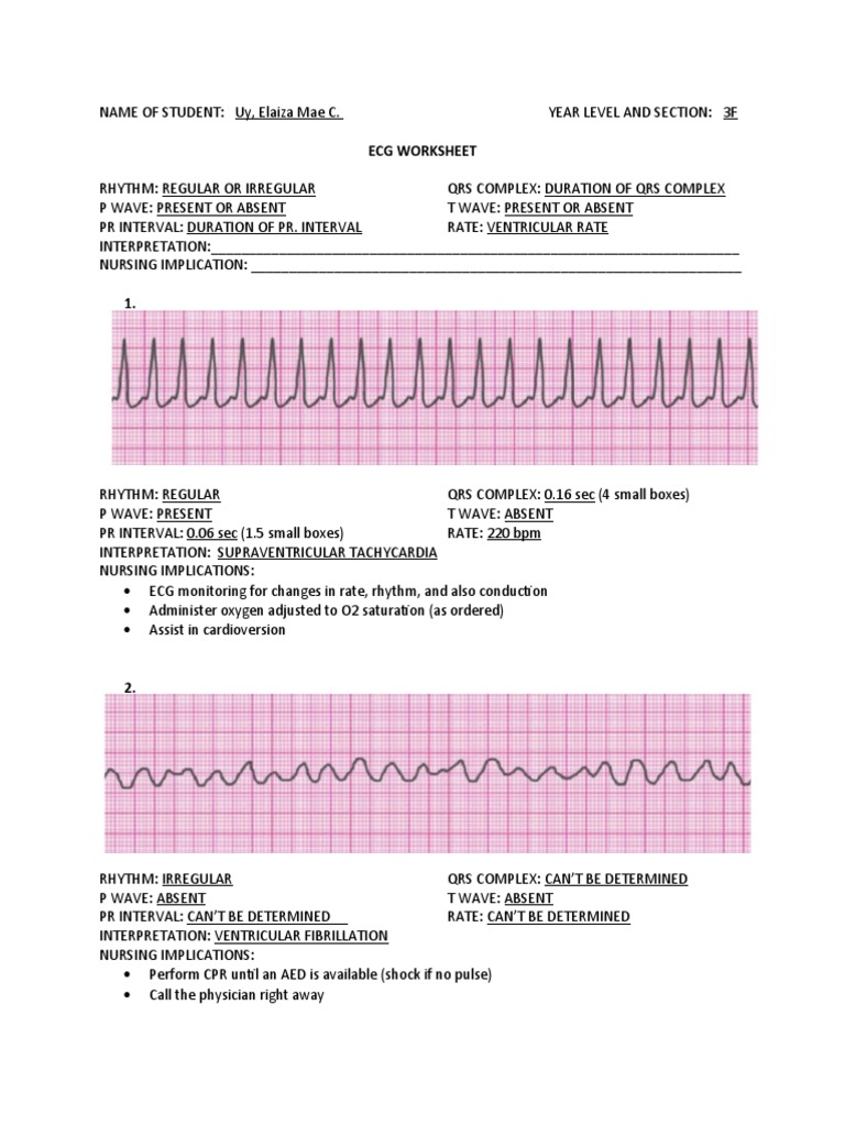 ECG Worksheet | PDF | Electrocardiography | Heart Rate