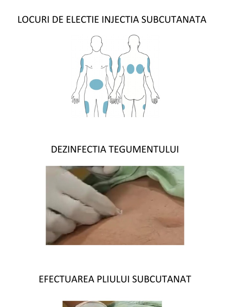 Locuri Electie Injectia Intramusculara Locuri de Electie - Injectia Subcutanata | PDF