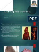 Craneoquisis o Acrania