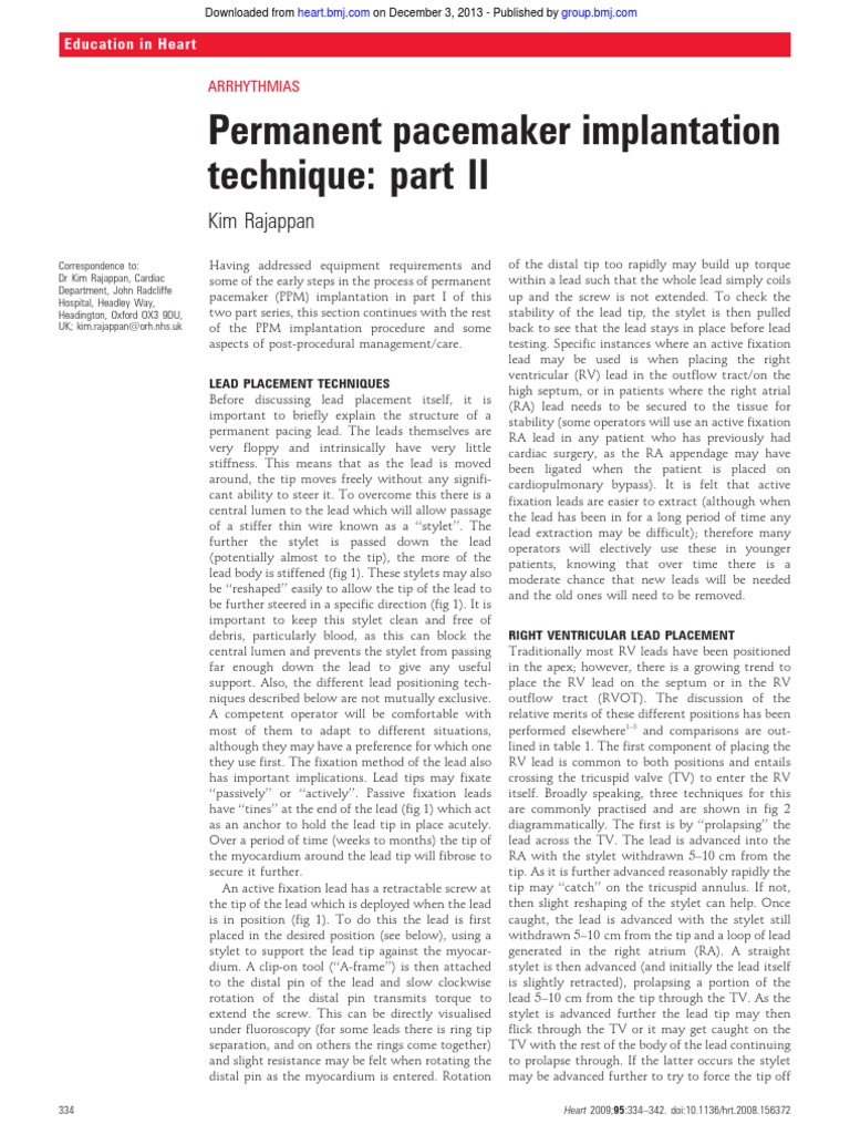 Permanent Pacemaker Implantation Technique Part II | PDF | Artificial ...
