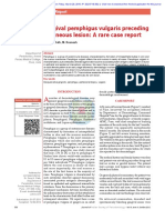 Gingival Pemphigus Vulgaris Preceding Cutaneous Lesion: A Rare Case Report