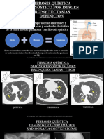 Fibrosis Quística Imagen Fer