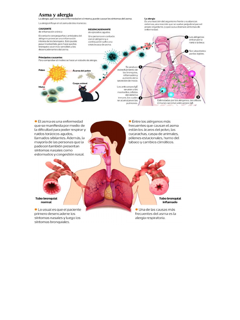 Alergías Pdf Alergia Asma