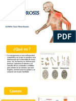 Osteoporosis: causas, síntomas y tratamiento