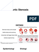 Aortic Stenosis