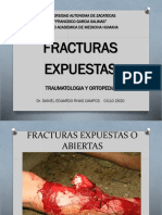 Fracturas Expuestas