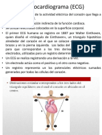 Electrocardiogram A