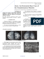 Breast Sarcoidosis An Extremely Rare Case of Idiopathic Granulomatous Mastitis