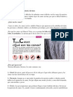 Tipos de Canas