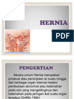 Hernia