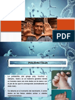 Polidactilia