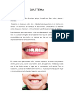 Diastema S