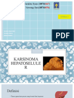 Karsinoma Hepatoseluler