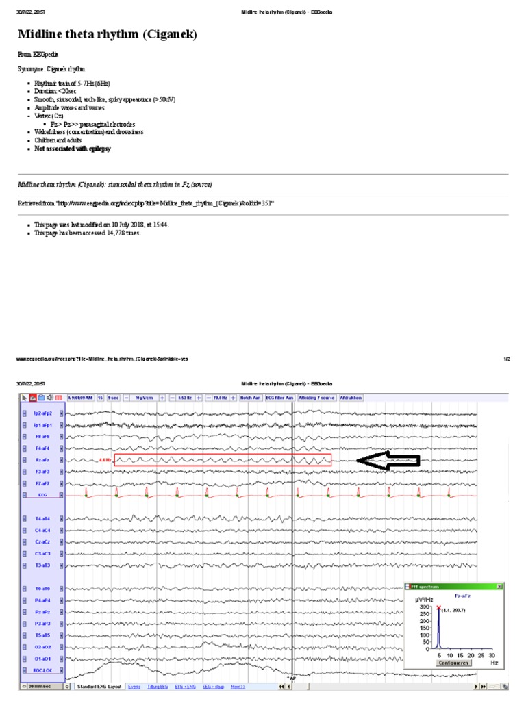 Midline Theta Rhythm (Ciganek) Overview | PDF