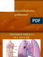 Factores de riesgo y diagnóstico del tromboembolismo pulmonar