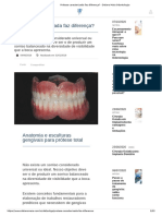 Prótese Caracterizada Faz Diferença - Delano Maia Odontologia