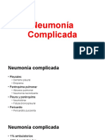 Neumonia Complicada