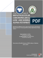 HCC with Low-Normal AFP: A Thesis on Hepatocellular Carcinoma Biomarkers