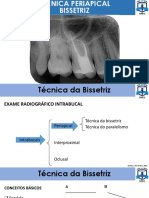 Técnica da Bissetriz Radiografia Periapical