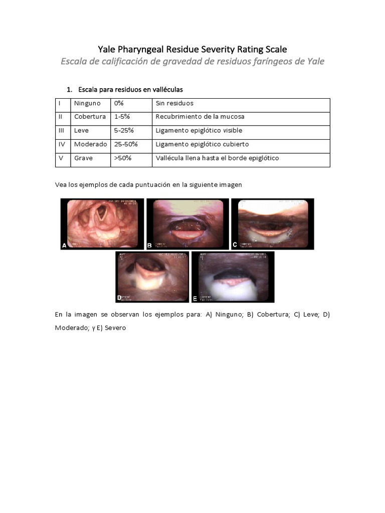 Yale Pharyngeal Residue Severity Rating Scale PDF