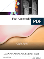 Foot Abnormality