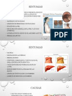 Cirrosis Hepatica (2