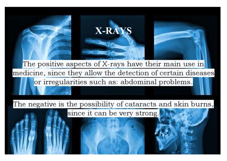 X Rays | PDF