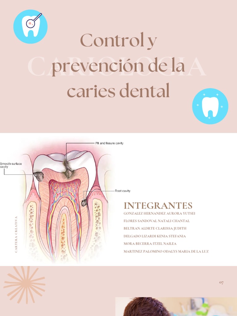 Control y Prevención de Las Caries | PDF | Higiene oral | Odontología