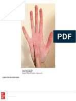 Figure (1) Hand