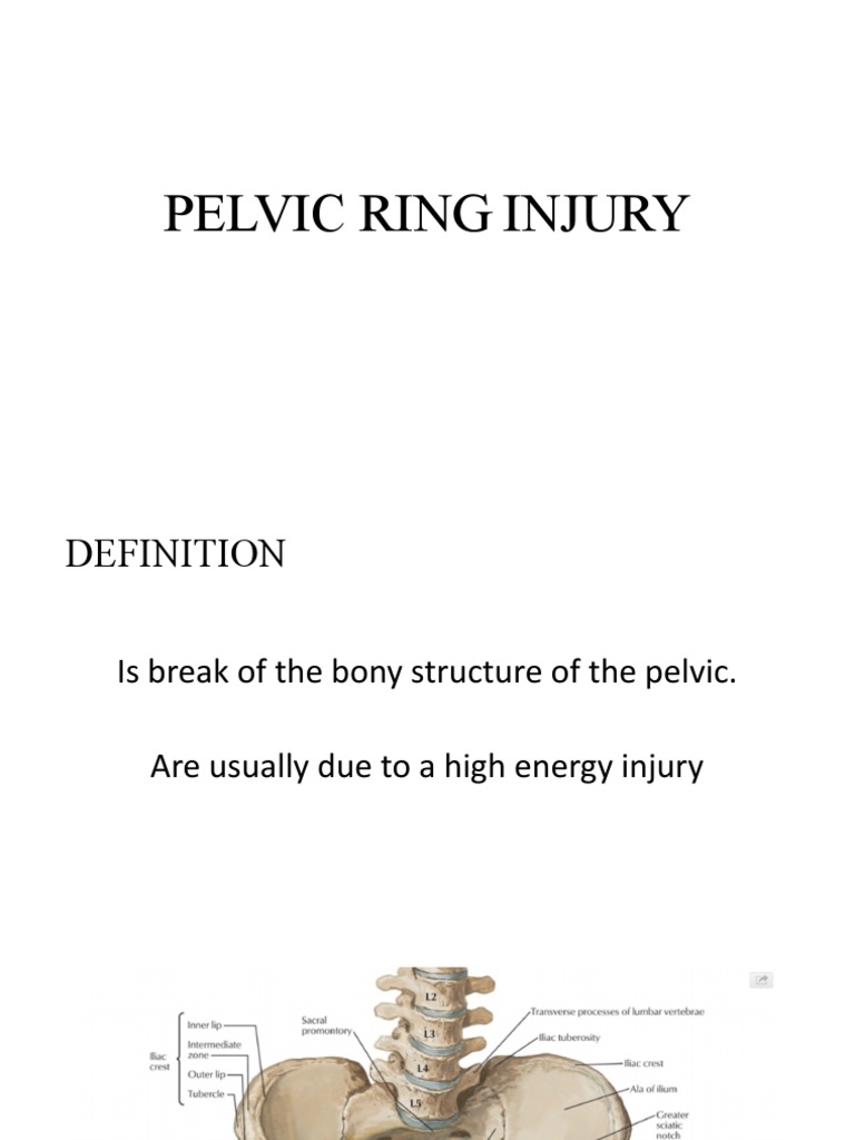Image Result For What Is Pelvic Instability Read Everything About It Here