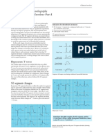 ABC of Clinical Electrocardiography Acute Myocardial Infarction—Part I