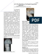 PT18D Transfibular Approach Tibial Plateau