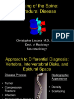 29 - Extradural Spine