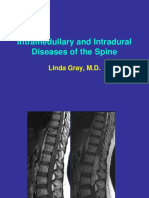 30 - Intradural Spine